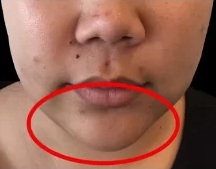 After CoolSwiss Prime Plus